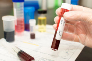 HIV - blood in a test tub